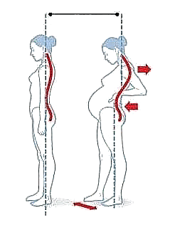 妊娠中の腰痛の原因
